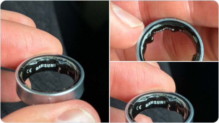 You asked how a smart ring sent a guy to the ER. Here’s the full story.
